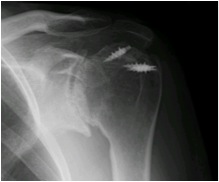 Anteroposterior View