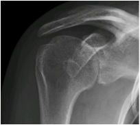 Anteroposterior View