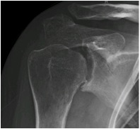 Anteroposterior View