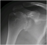 Anteroposterior View