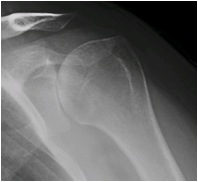 Anteroposterior View