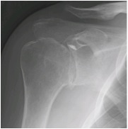 Anteroposterior View
