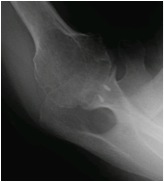 Axillary View