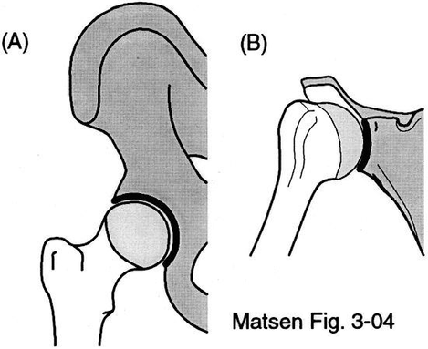 Figure 2 - Deep socket