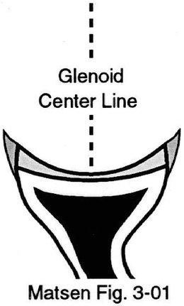 Figure 6 - Glenoid center line
