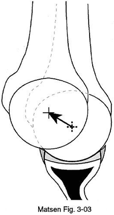 Figure 8 - Glenohumeral translation