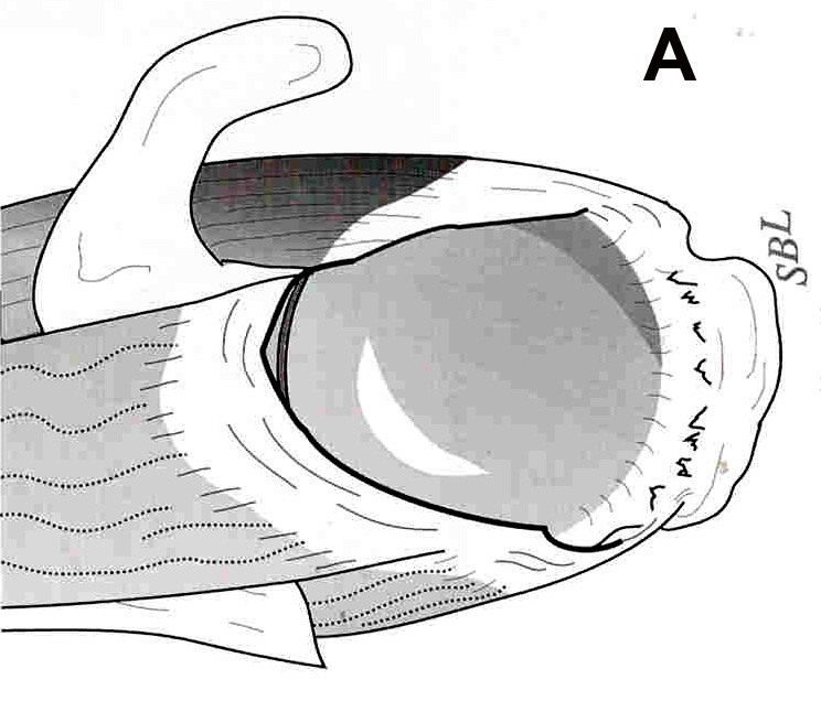 Figure 7a. Diagramatic (A) and arthroscopic (B) views of a massive,
