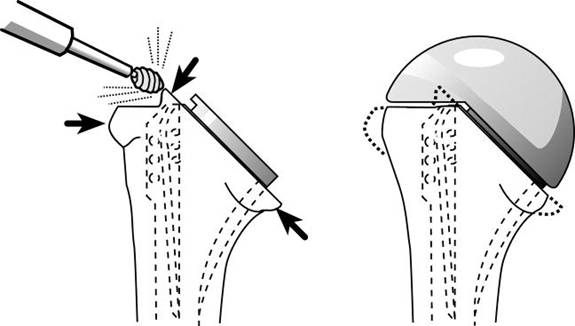 Figure 28