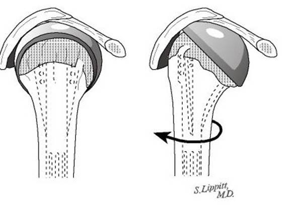 Figure 29