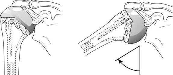 Figure 30