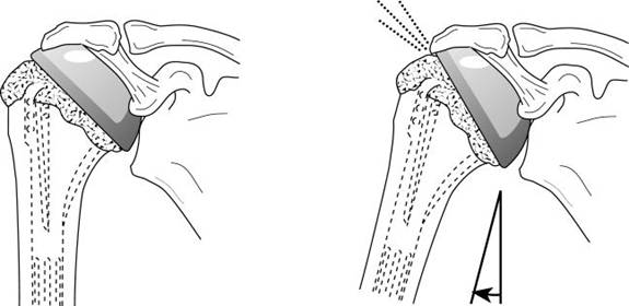 Figure 31