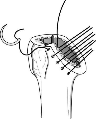 Figure 33