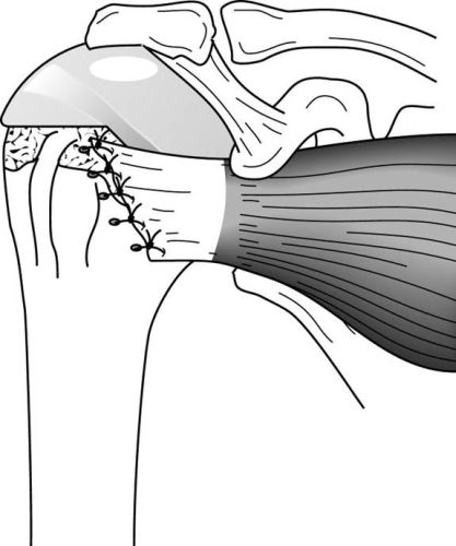 Figure 34