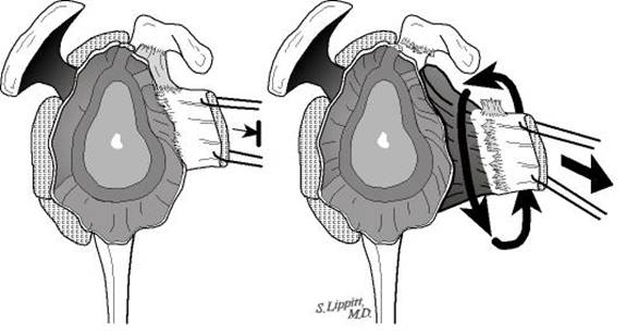Figure 21