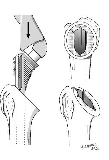 Figure 22