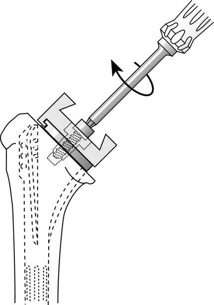 Figure 24