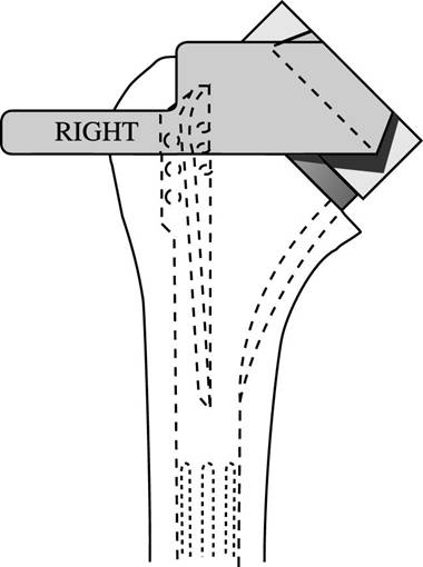Figure 26