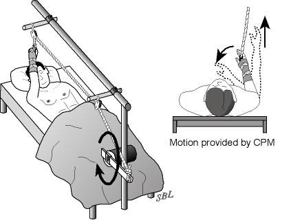 Figure 36