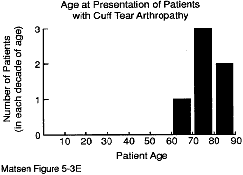 Figure 5 - Age at the time of presentation for cuff tear arthropathy