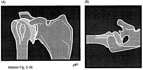 Figure 9 - Radiographs of dejenerative joint disease