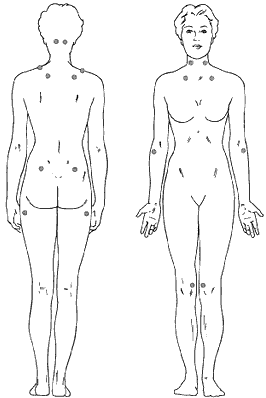 Figure 1 - Dots indicate possible locations of tender points
