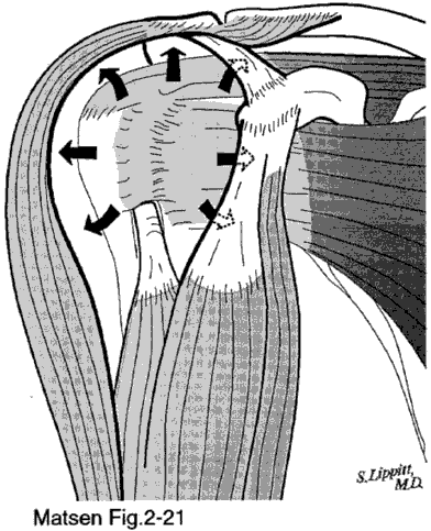 Figure 1 - The sleeve