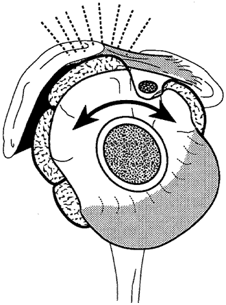 Figure 3 - Localized abrasion