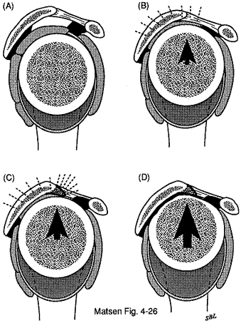 Figure 4 - Repeated forced contact