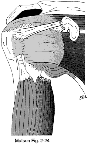 Figure 5 - Coracohumeral ligament