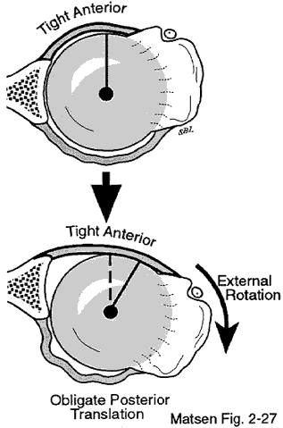 Figure 8 - Humeral head is forced posteriorly