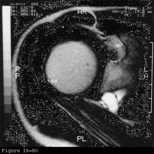Rotator Cuff Differential Diagnosis UW Orthopaedics and Sports