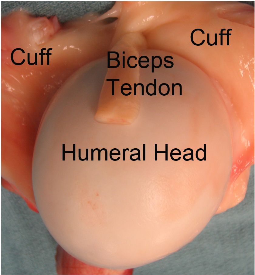 The Rotator Cuff Attach To The Humeral Head