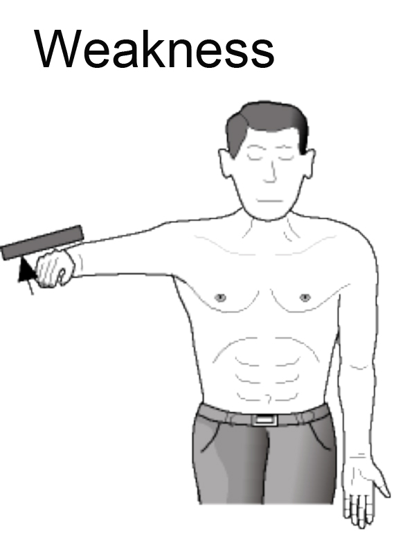 Diagnosed A Rotator Cuff Tear - Weakness