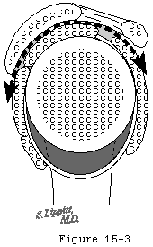 Figure 15