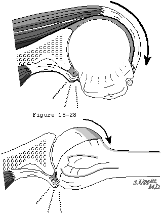 Figure 24