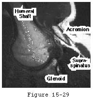 Figure 25