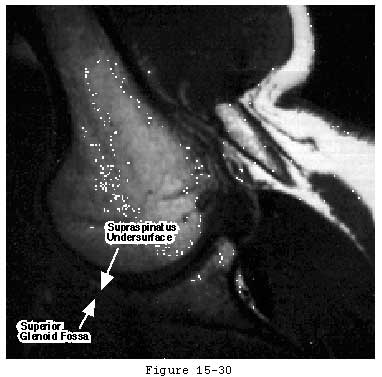 Figure 26