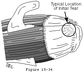 Figure 32
