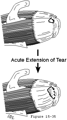 Figure 33