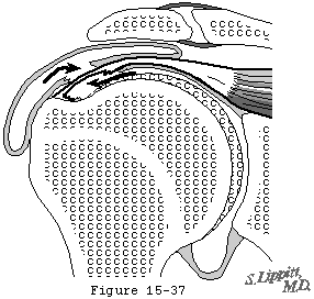 Figure 35