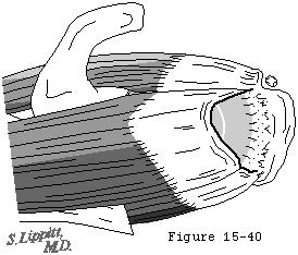Figure 38
