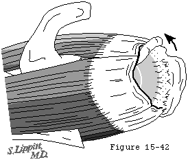 Figure 41