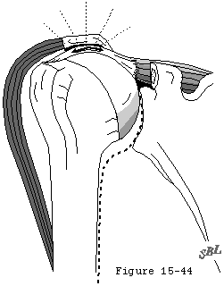 Figure 43