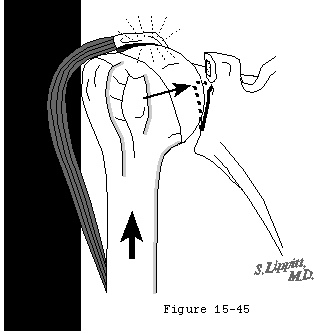 Figure 44