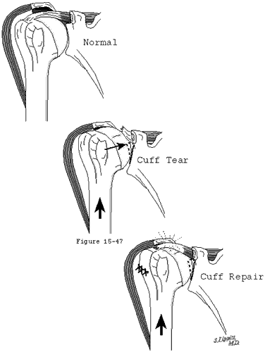Figure 46