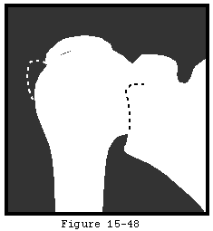 Figure 47