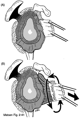 Figure 3 - 360 degree release
