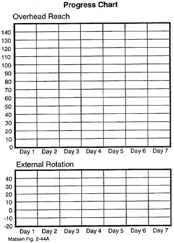 Figure 7 - Sample empty progress chart