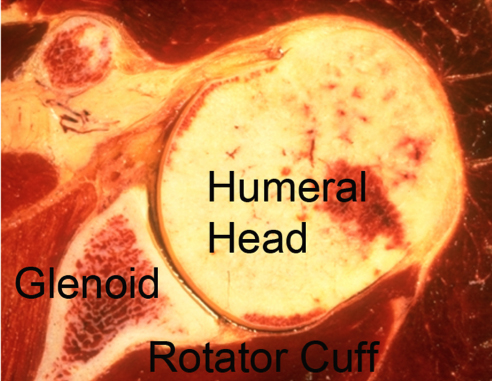 Normal Shoulder