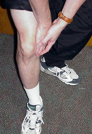 Figure 6 - Knee arthritis can affect any of the three compartments of the knee. Medial-sided knee pain located on the part of the knee that faces the opposite knee is the most common location for arthritic pain.